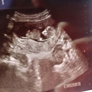 Meet your Posher, Kenkade